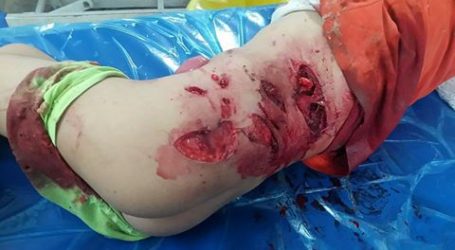 حمله سگ هار به کودک ۷ ساله روستا